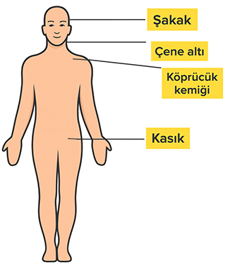 Soru görseli